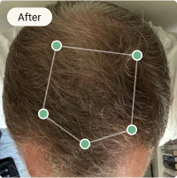 After Treatment