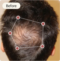 Before Treatment