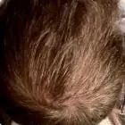 After Image