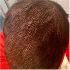 After Image
