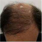 After Image