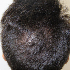 After Image