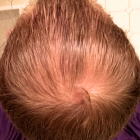 Before Image