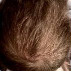 After Image