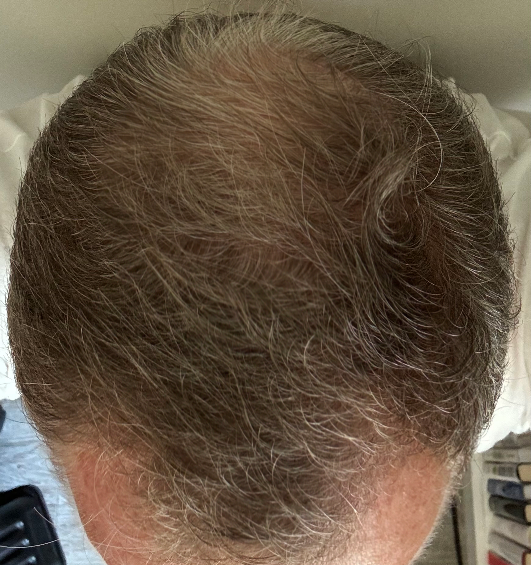 After treatment