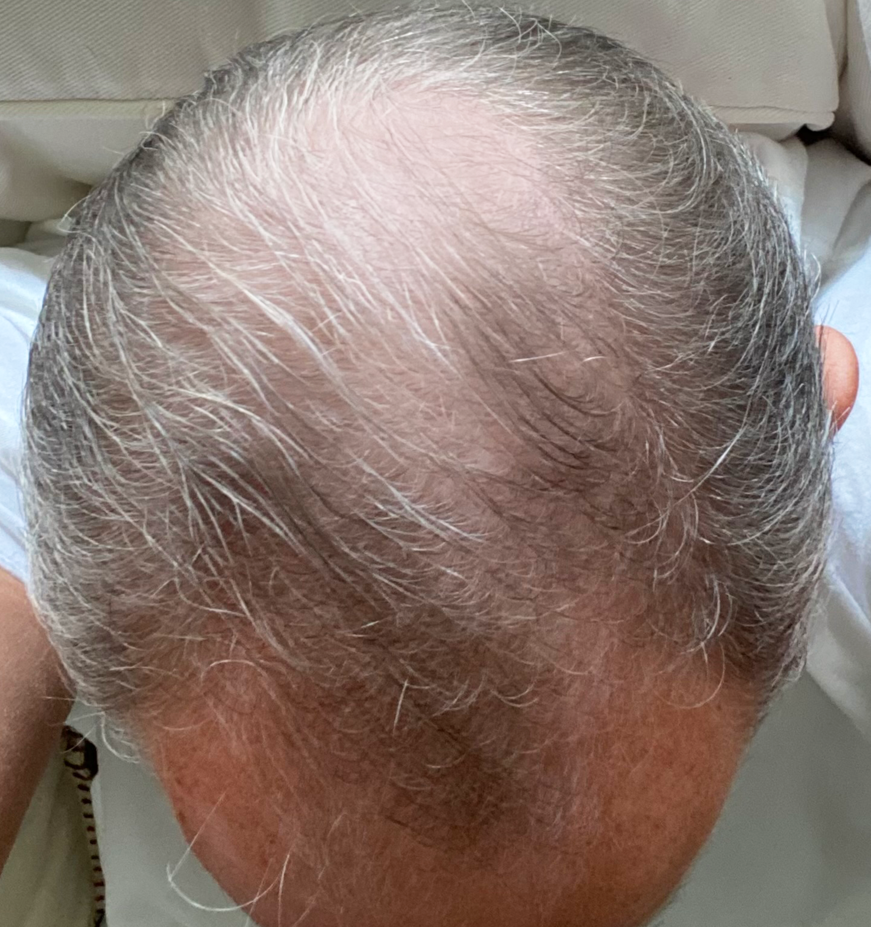 Before treatment