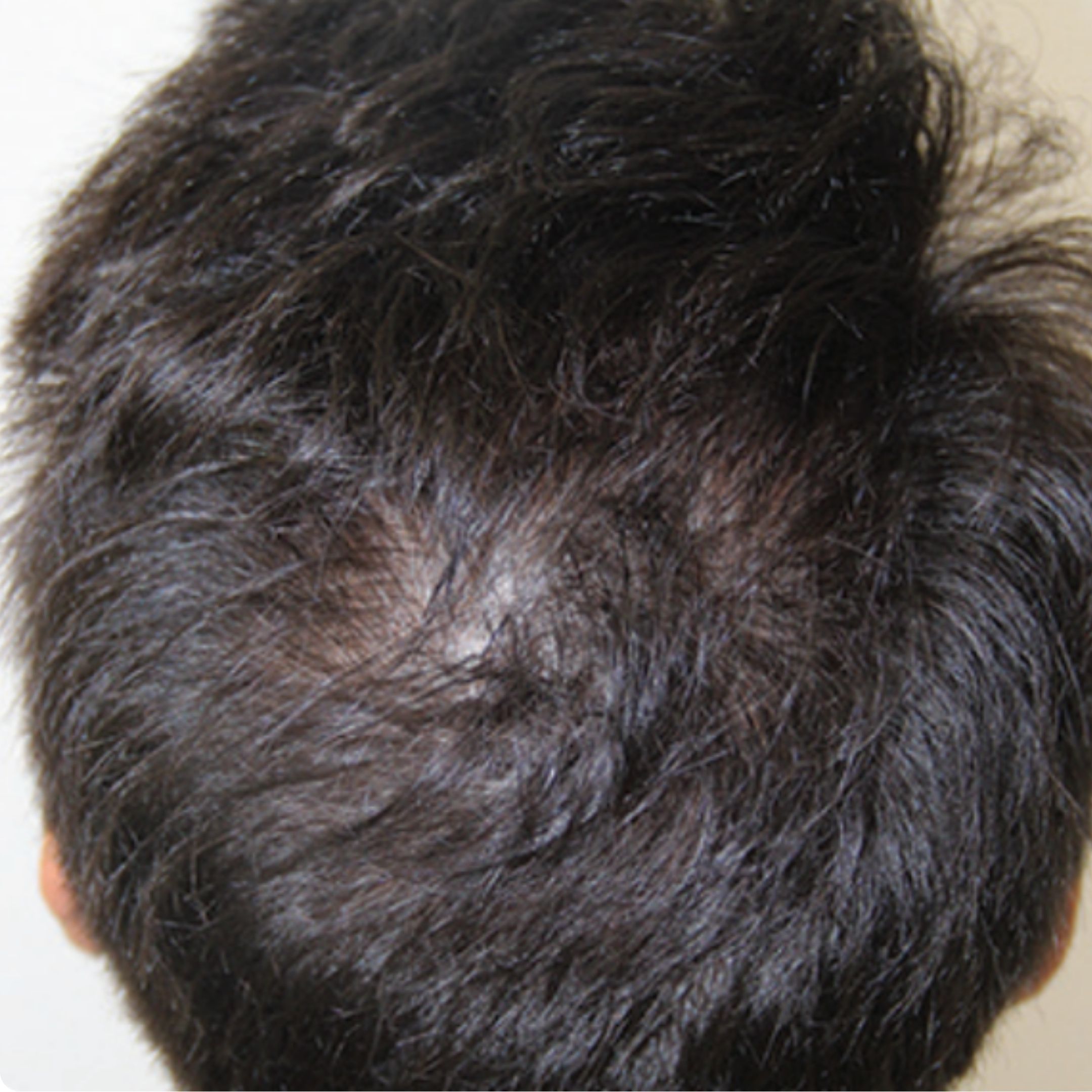 After treatment