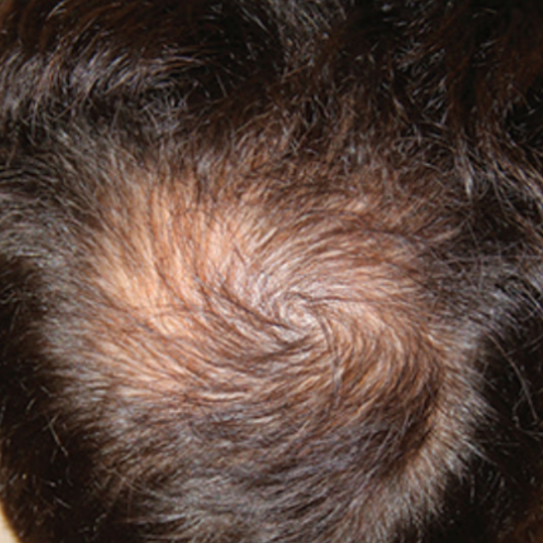 Before treatment