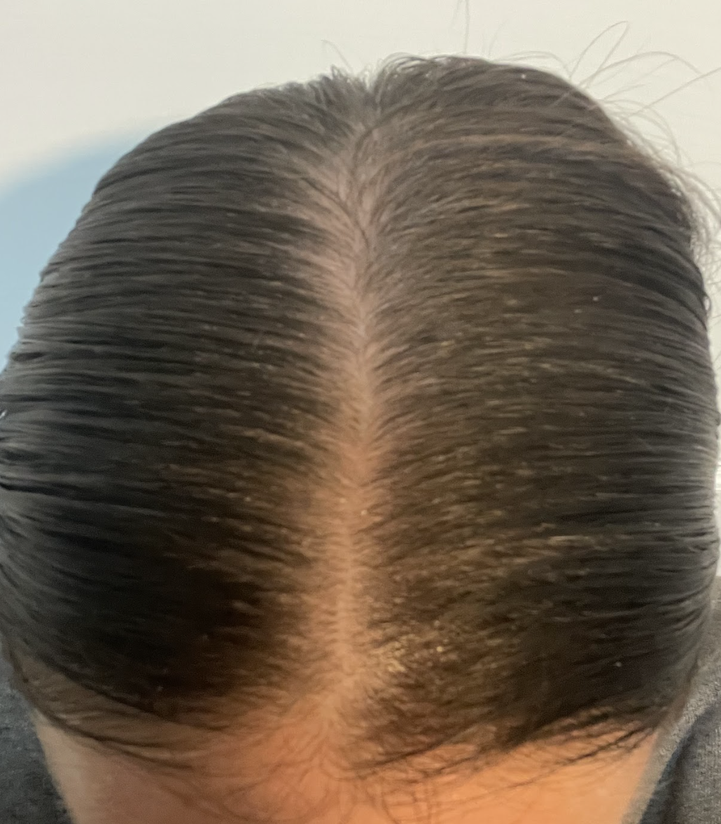 After treatment