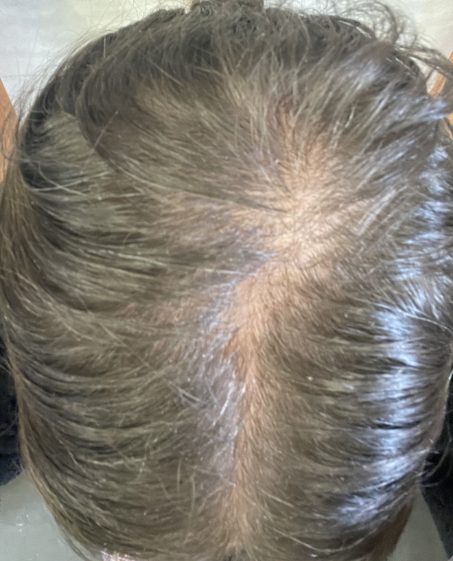 Before treatment