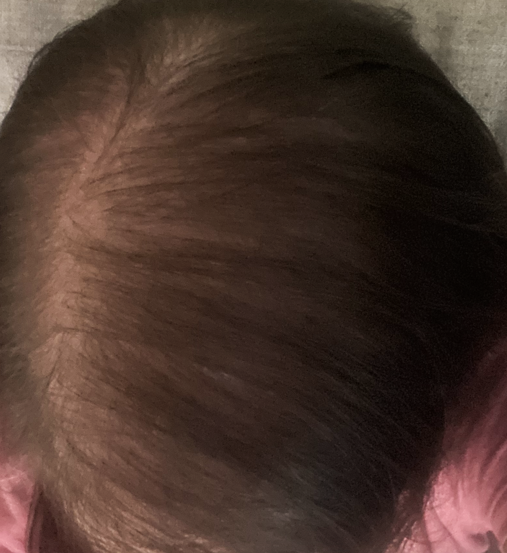 After treatment