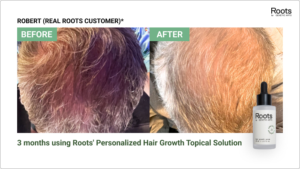 Analyzing hair DNA test sample